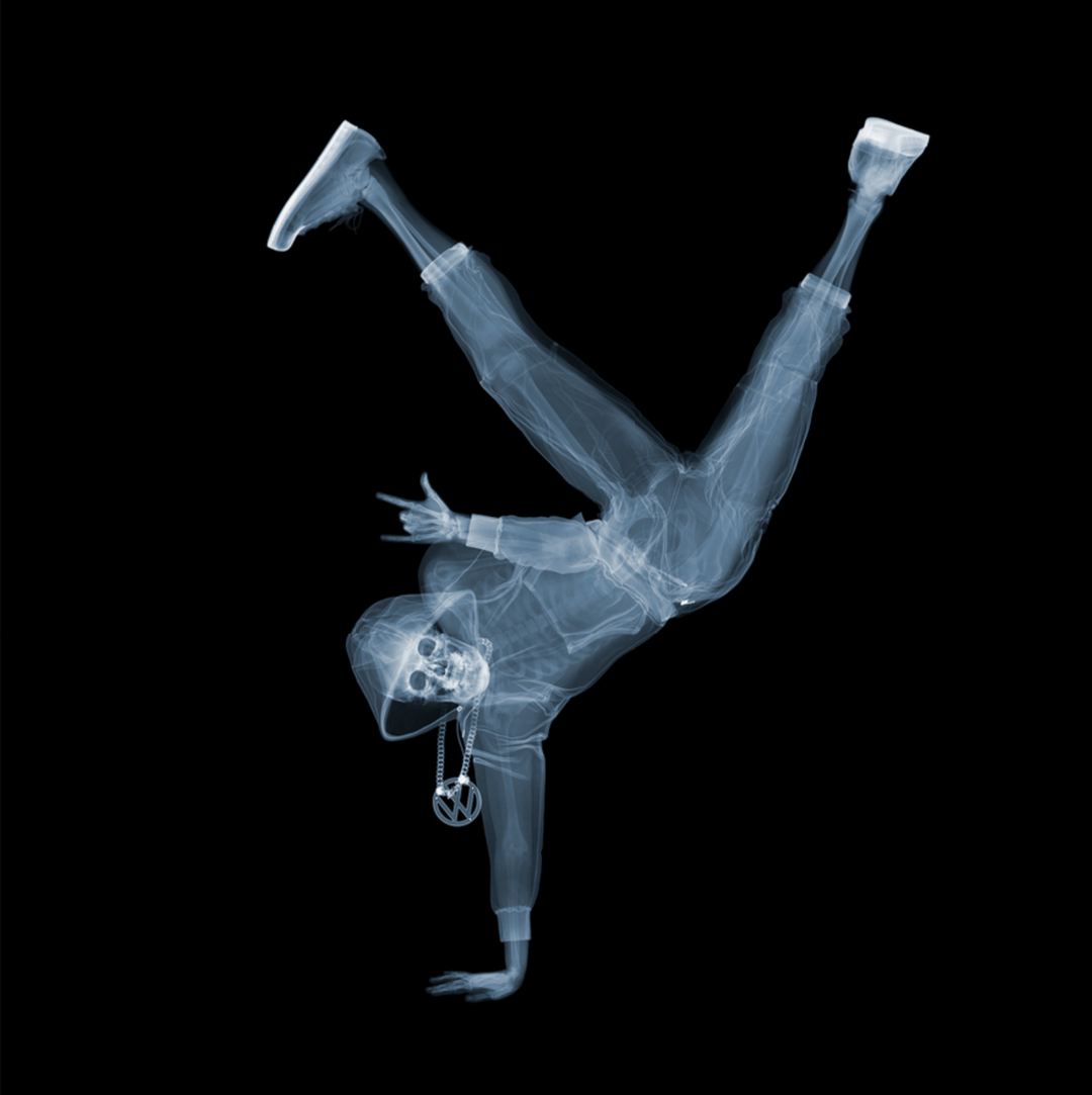 Breakdancer by Nick Veasey