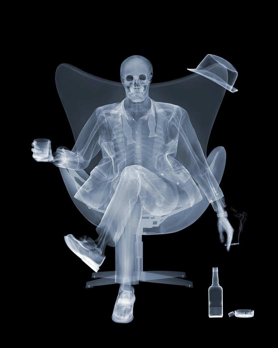 Nick Veasey X Ray Art Available from Startle 