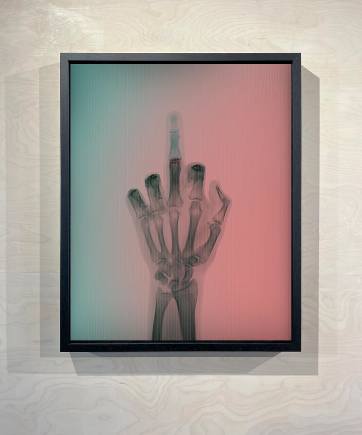 A limited edition Lenticular print by Nick Veasey of an X-Rayed hand with it&