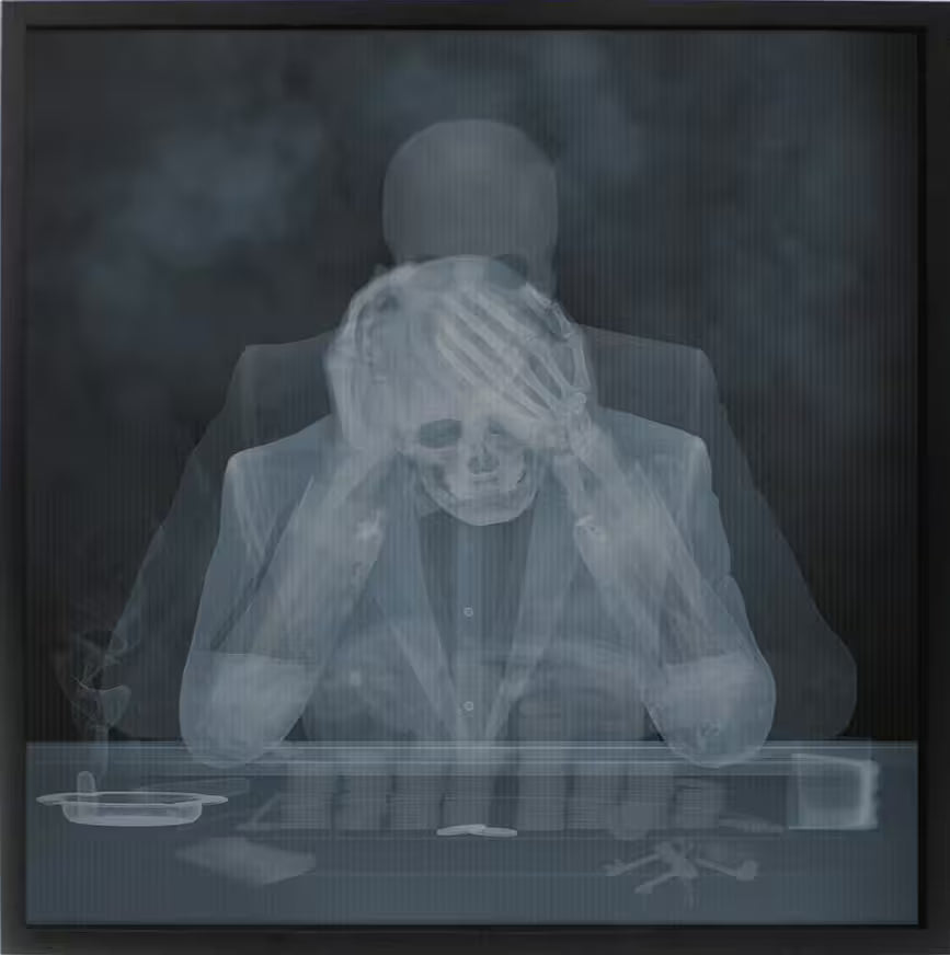 A limited edition lenticular print by Nick Veasey of an X-Rayed black jack player, their skeleton is holding their head, the title is Loosing Streak