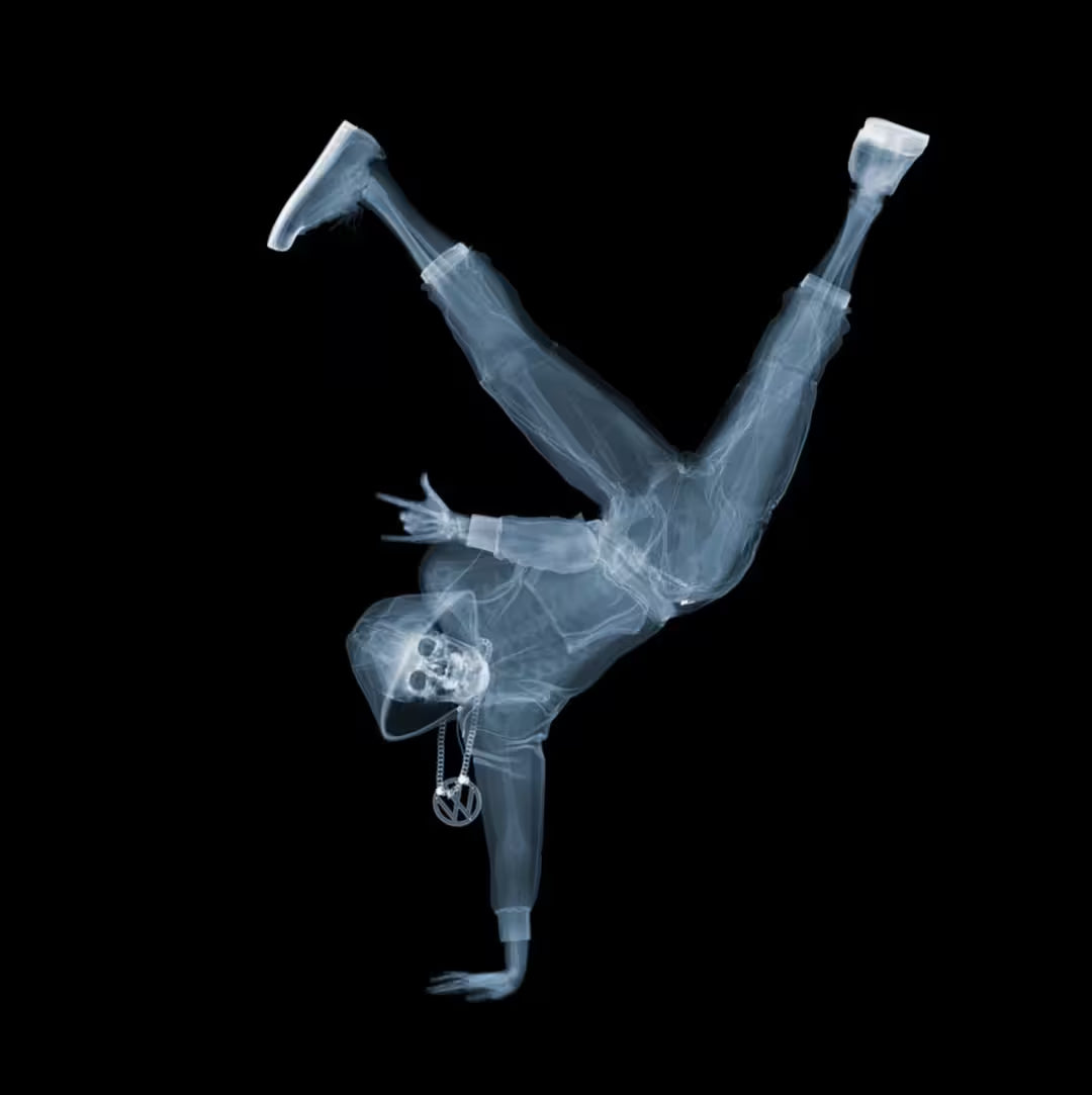 A limited edition Chromaluxe print by Nick Veasey of an X-Rayed breakdancer showing their skeleton in a tracksuit doing a trick, the title is Breakdancer