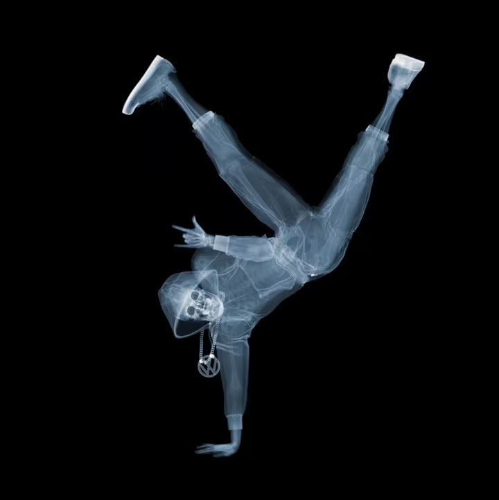 A limited edition Chromaluxe print by Nick Veasey of an X-Rayed breakdancer showing their skeleton in a tracksuit doing a trick, the title is Breakdancer